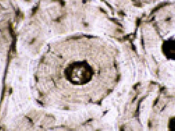 Microscopic close up of bone
