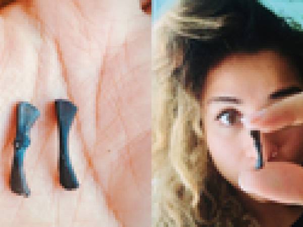 Yara holding up tiny bones with preserved injuries