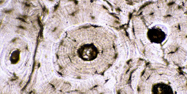Microscopic close up of bone